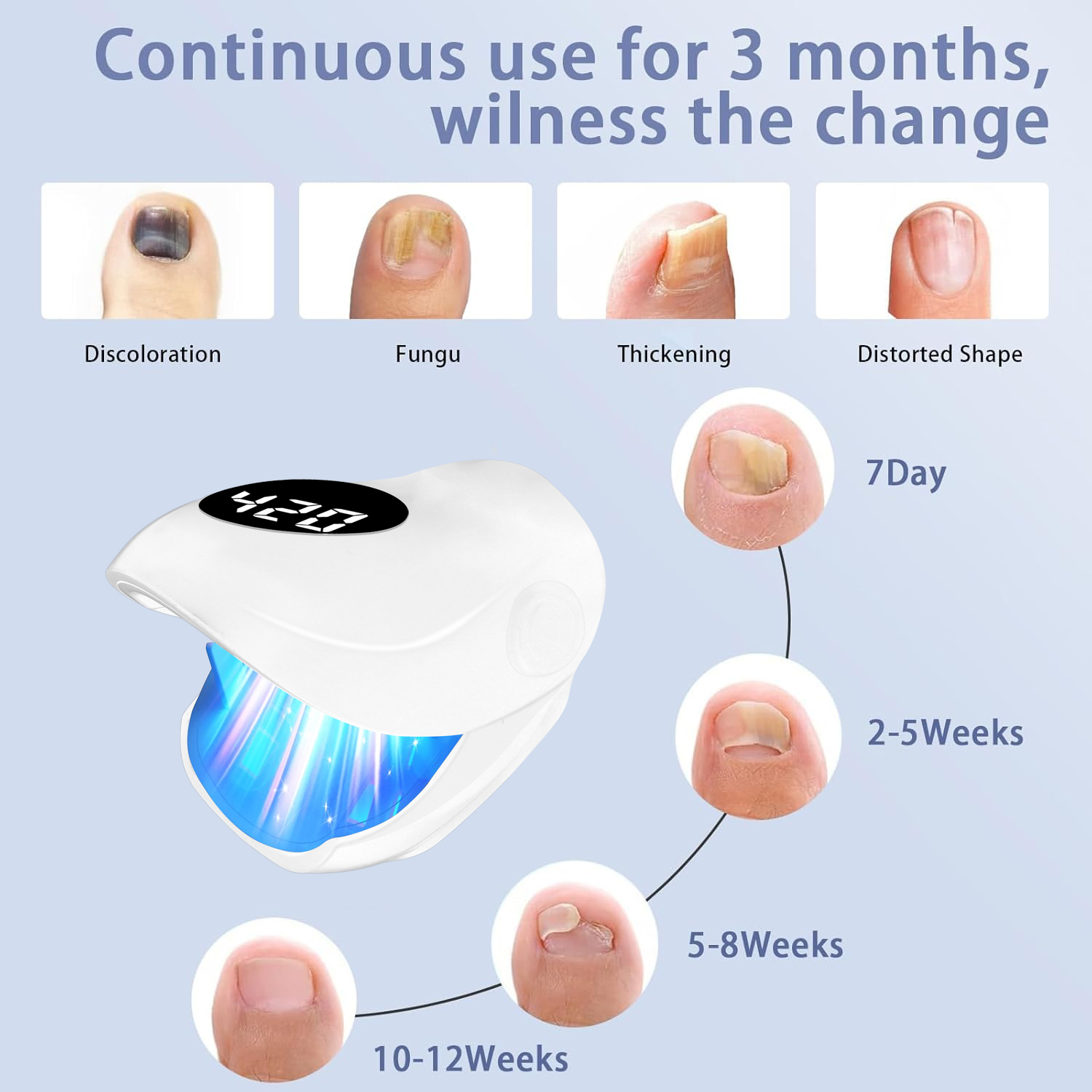 Effective Nail Fungus Removal  - đánh giá và giá Industrial Laser Removal